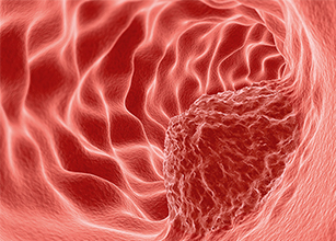 Tumor Marker Rapid Test